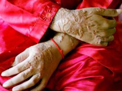 acid attack on mother and daughter