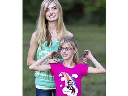teen born with rare medical condition