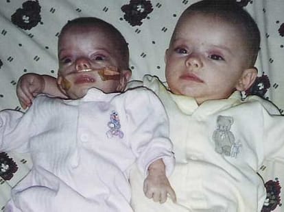 teen born with rare medical condition