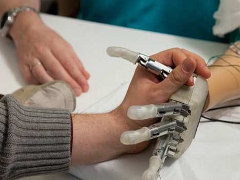 artificial hand can give natural sensations