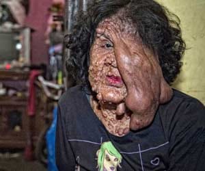 woman suffering from rare medical case