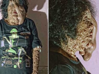 woman suffering from rare medical case