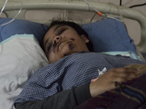 stunt biker injured girl student
