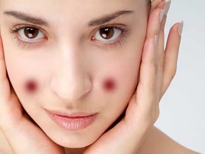 acupressure points for glowing skin