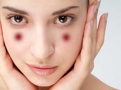 acupressure points for glowing skin