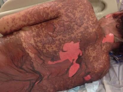 rare syndrom problem