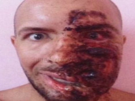 tourist left with horrific injuries after he rang a bell unknowingly