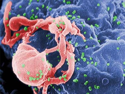 One more HIV positive child became healthy 