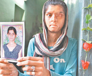 Acid attack on Ritu