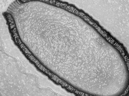 climate_change_small_pox