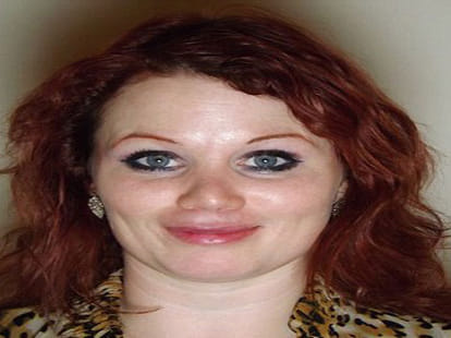 plastic surgery goes wrong, women left with weired nose job