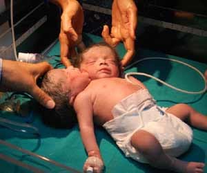 two headed girl 