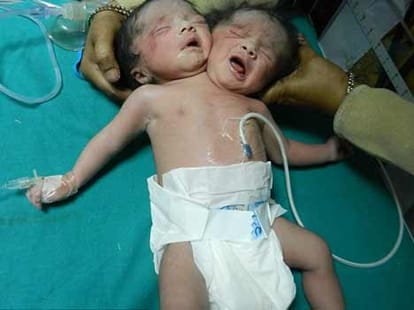 two headed girl 