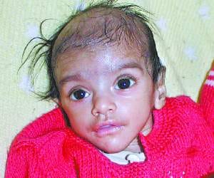 again one child sick in creche