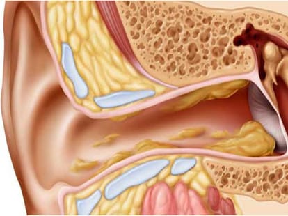 ear wax related facts