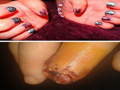nail art went wrong
