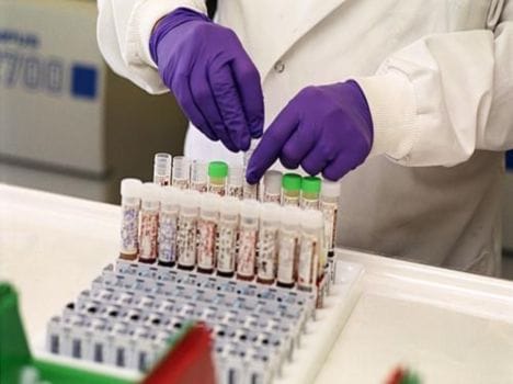 Illegal recovery in the name of Tests 