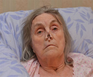 docs failed to detect tumour in nose