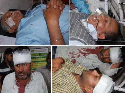accident in Panchkula - Shimla highway, 16 injured