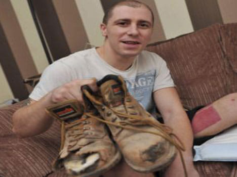 man life saved by his steel toe shoes