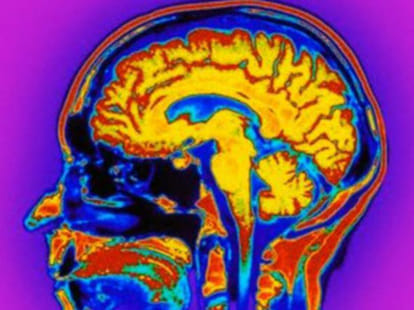 scientists invent 'thinking cap', enables brain to act smarter 