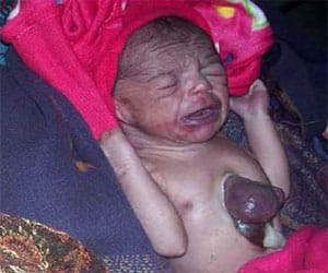 wonder! child with heart outside his chest