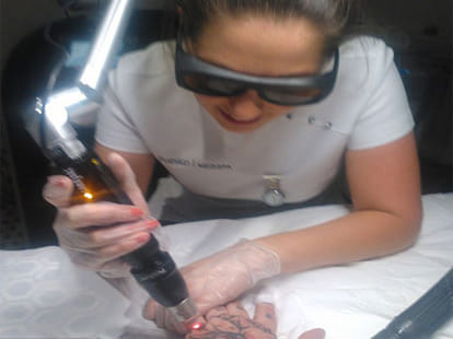 man undergoes tatoo removal surgery to start once again