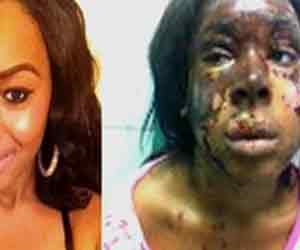 acid attack on a lady by her friend for coments