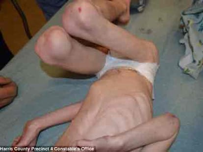 Texas couple starved 5-year-old son, kept him locked in stairway closet