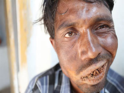 man who eats three kilos of debris each day!