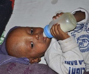 aakash suffured by progeria disease