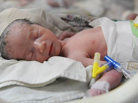 cooling therapy for new born babies