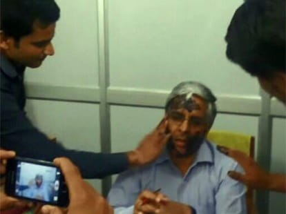 ink attack on delhi university south campus director