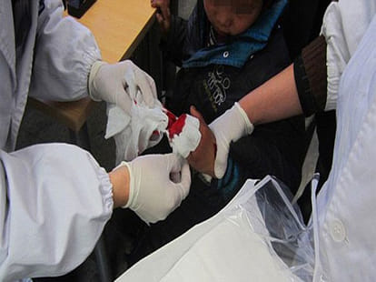 mother chops off son's finger