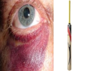 Mother-in-law beating with cricket bat 