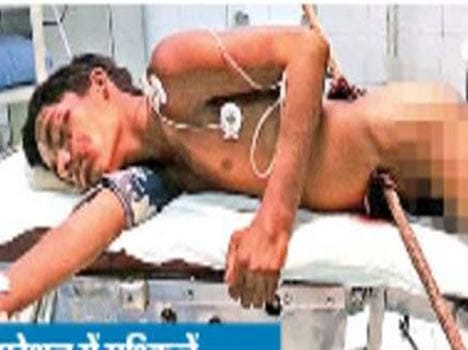 nosogenic accident in lucknow
