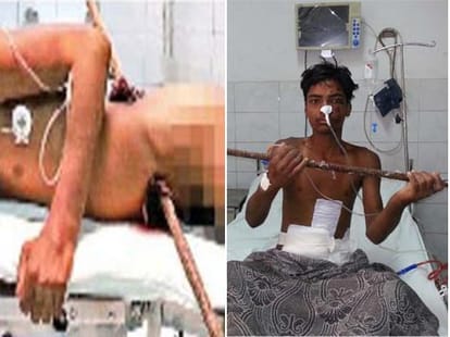 nosogenic accident in lucknow