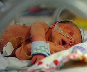 baby born with just half a heart