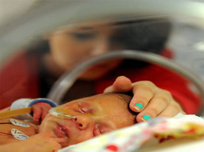 baby born with just half a heart