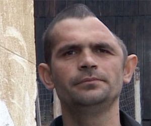 man with half a head