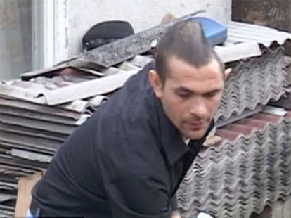 man with half a head
