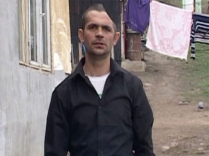 man with half a head