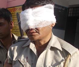 Sub inspector injured accident in noida