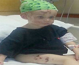 mother who bits off dog's ears to save daughter