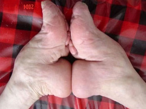 foot binding in china