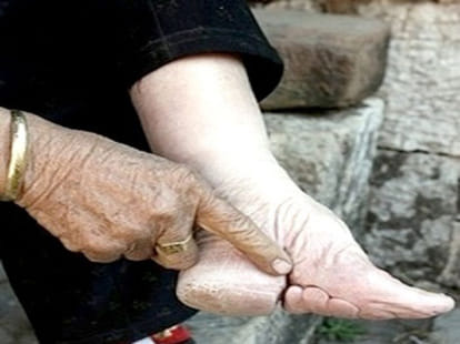 foot binding in china