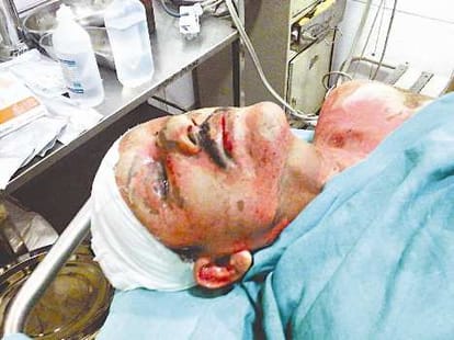 bsp leader kamrujjma fouji died in lucknow