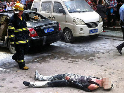 man ties gas canister girlfriend got pregnant mistake ignites seat car Severely burned woman