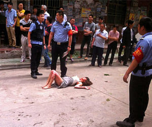 man ties gas canister girlfriend got pregnant mistake ignites seat car Severely burned woman
