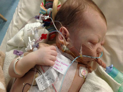baby girl saved by a cow's heart